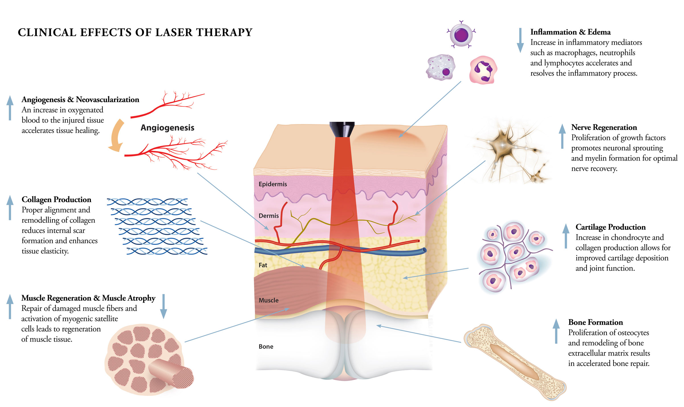 How Does Laser Therapy Work Vitality Depot