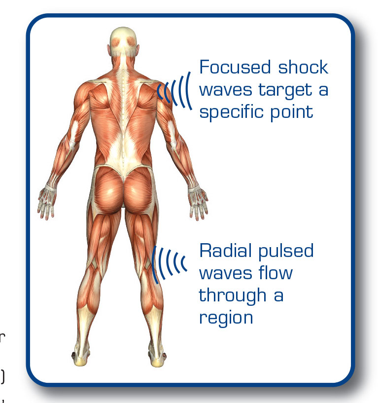 enPuls - Radial Shockwave Therapy